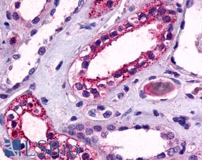 PathPlus™ Polyclonal Rabbit anti-Human TPRA1 / GPR175 Antibody (N-Terminus, IHC)