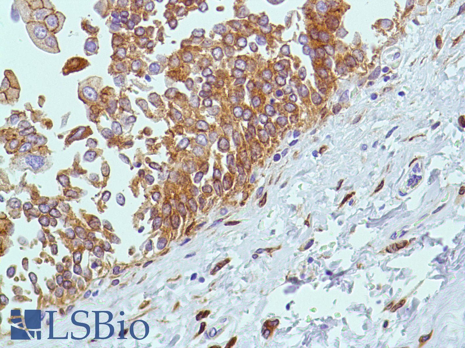 PTGS2 / COX2 / COX-2 Antibody (C-Terminus, clone SP21)