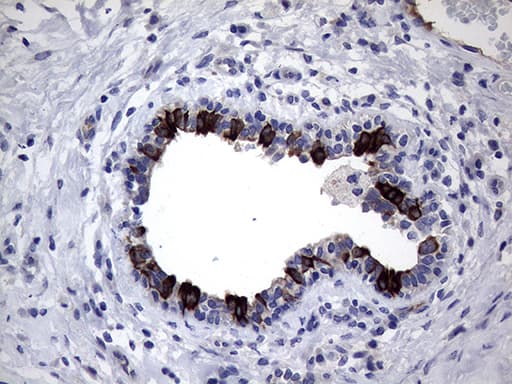 KRT18 / CK18 / Cytokeratin 18 Antibody (aa69-372, clone OTI10G8)