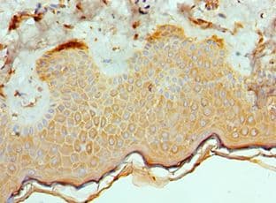 ETV6 / TEL Antibody (aa1-300)