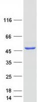 Human SCCPDH Protein (Recombinant Myc-DDK (Flag))
