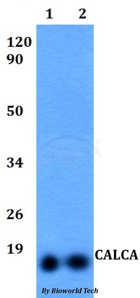 CALCA Antibody