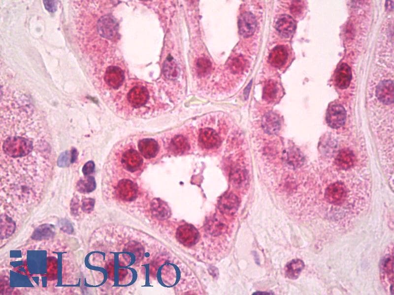 PathPlus™ SMARCA4 / BRG1 Antibody (aa75-125)