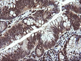 MAP2K1 / MKK1 / MEK1 Antibody (clone OTI2E8)