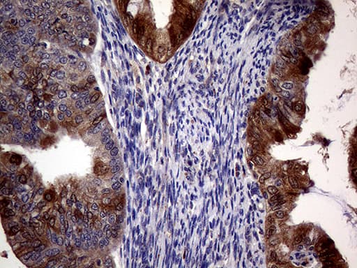 p16INK4a / CDKN2A Antibody (clone OTI10F12)