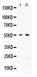 Polyclonal Rabbit anti-Human ACTRIIB / ACVR2B Antibody (WB)