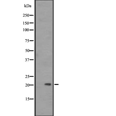 PAEP / Glycodelin / GdF Antibody