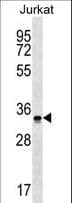 OR2G6 Antibody (aa1-30)