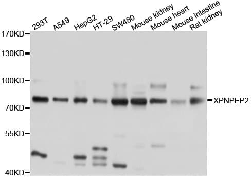 Polyclonal Rabbit anti-Human XPNPEP2 Antibody (WB)