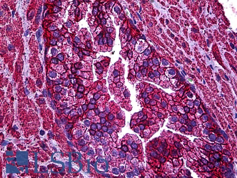 IHC-plus™ ABCC4 / MRP4 Antibody (clone 1B2)