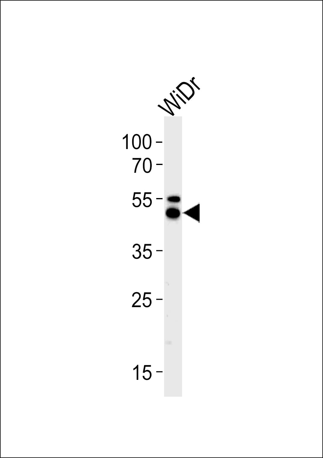 KRT20 / CK20 / Cytokeratin 20 Antibody (aa377-401)