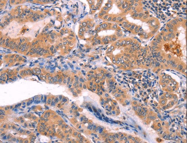 Polyclonal Rabbit anti-Human NCEH1 / AADACL1 Antibody (IHC, WB)