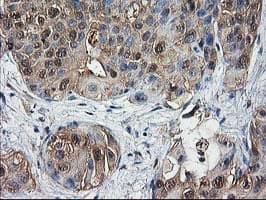 DSTN / Destrin Antibody (clone OTI1C5, Carrier-free)