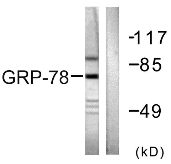HSPA5 / GRP78 / BiP Antibody