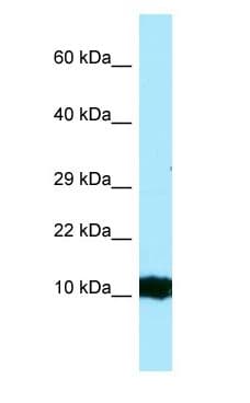 HBG2 / Hemoglobin Gamma 2 Antibody (aa56-105)