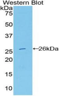 DNASE1L2 Antibody (aa32-229)