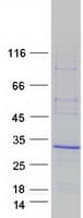 Human ARL4C Protein (Recombinant Myc-DDK (Flag))