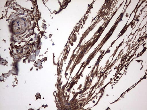 IL1RN Antibody (clone OTI2B1)
