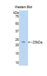 ANXA1 / Annexin A1 Antibody (aa208-336, Biotin)