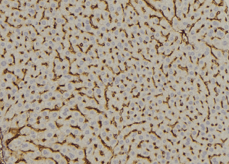 DOK2 Antibody