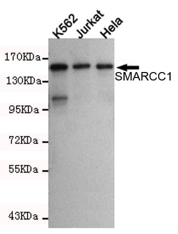 SMARCC1 / SWI3 Antibody
