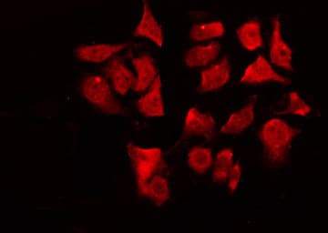 Polyclonal Rabbit anti-Human CHEK1 / CHK1 Antibody (phospho-Ser280, IHC, IF, WB)