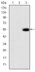 Monoclonal Mouse anti-Human MMP9 / Gelatinase B Antibody (clone 5G3, IHC, IF, WB)