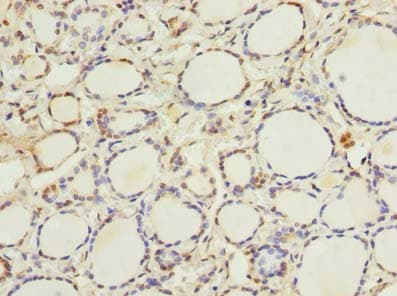 ETNK1 / Ethanolamine Kinase 2 Antibody