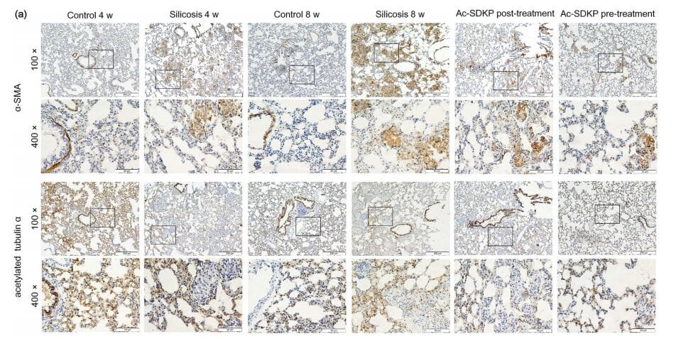 ACTA2 / Smooth Muscle Actin Antibody