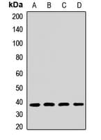 NDUFAF5 Antibody