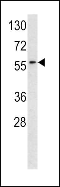 Polyclonal Rabbit anti-Human RYK Antibody (aa383-410, WB)
