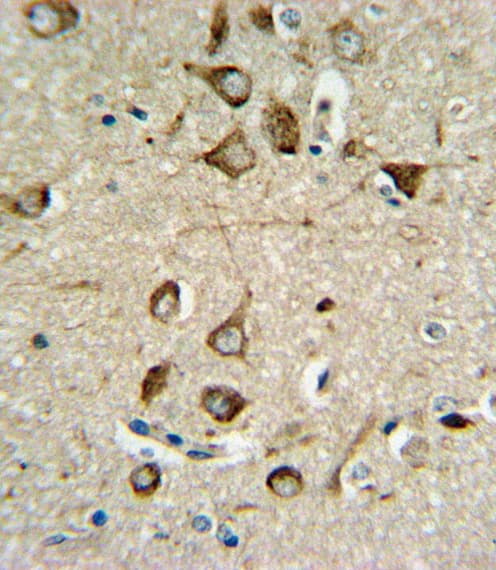 ASMT / HIOMT Antibody (aa212-241)