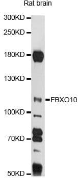 Polyclonal Rabbit anti-Human FBXO10 Antibody (WB)