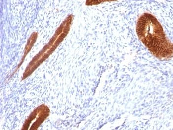 KRT7 / CK7 / Cytokeratin 7 Antibody (clone KRT7/760, Ready-to-Use)