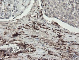 F13A1 / Factor XIIIa Antibody (clone 6F5, Carrier-free)