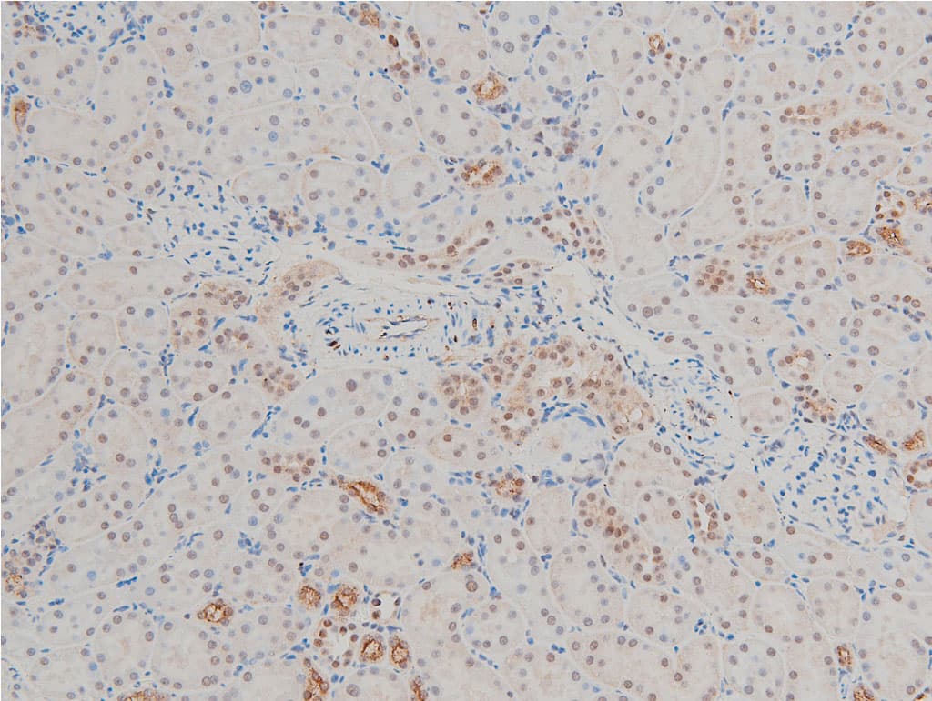 CFL1 / Cofilin Antibody (phospho-Ser3)