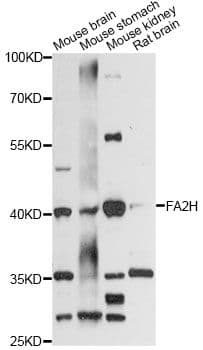 FA2H / FAAH Antibody
