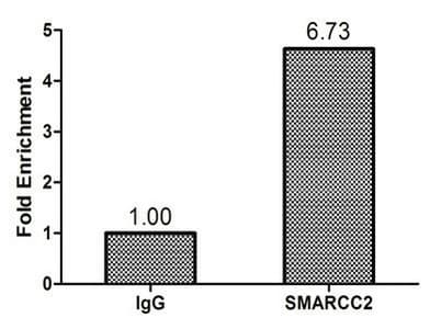 Polyclonal Rabbit anti-Human SMARCC2 Antibody (aa300-650, IHC, WB)