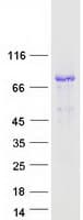 Human DMPK / DM Protein (Recombinant Myc-DDK (Flag))