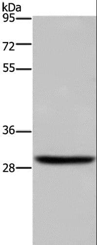 DHRS3 / SDR1 Antibody