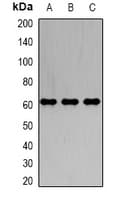 Polyclonal Rabbit anti-Human BAIAP2 / IRSP53 Antibody (IHC, IF, WB)