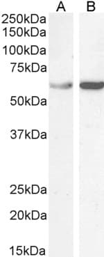IHC-plus™ TCP1 Antibody (aa544-556)