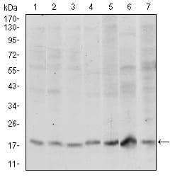 IHC-plus™ SKP1 Antibody (clone 1H9)