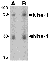 SLC9A1 / NHE1 Antibody