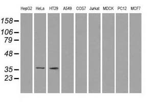 Monoclonal Mouse anti-Human SORD / Sorbitol Dehydrogenase Antibody (clone OTI9E7, IHC, IF, WB)