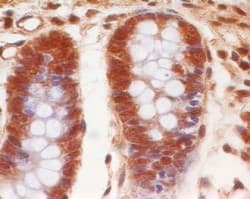 Monoclonal Mouse anti-Human EPS8 Antibody (clone 18F1F2, aa701-882, IHC, WB)