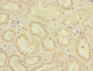 CD32C Antibody