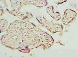LRRC42 Antibody