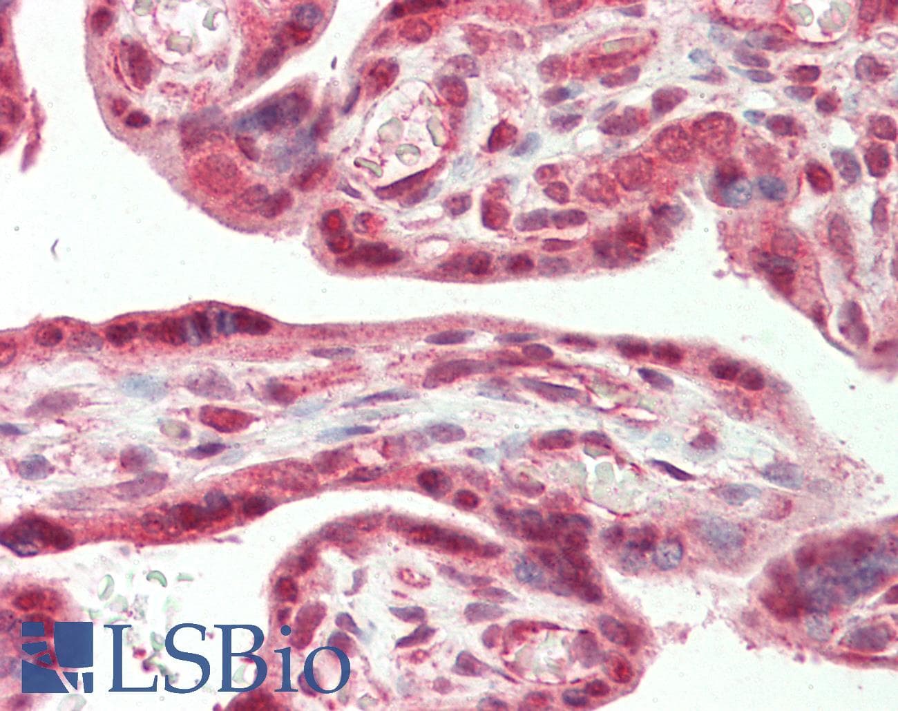 IHC-plus™ Polyclonal Rabbit anti-Human CSNK2A2 Antibody (aa300-C-term, IHC, WB)