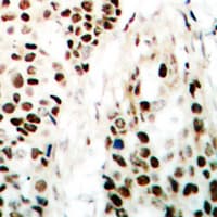 ZC3HC1 / NIPA Antibody (Internal)